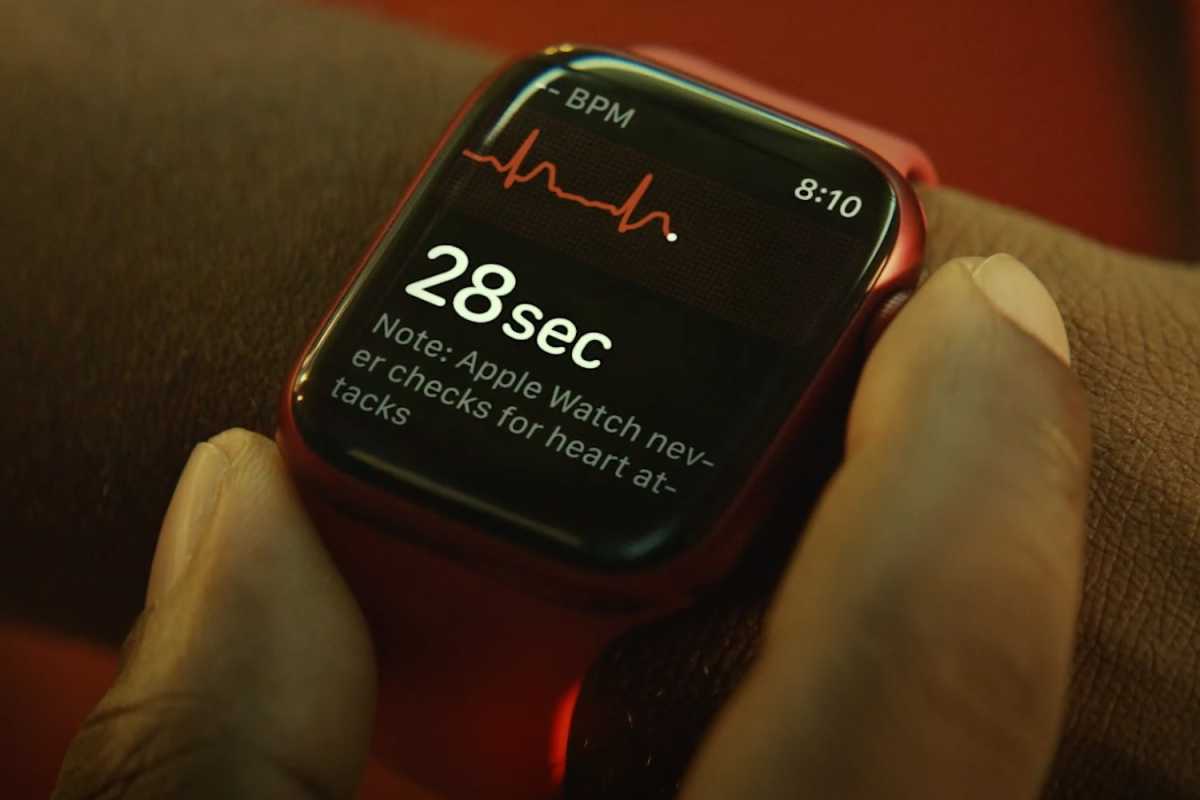 Apple Watch Série 7 Électrocardiogramme