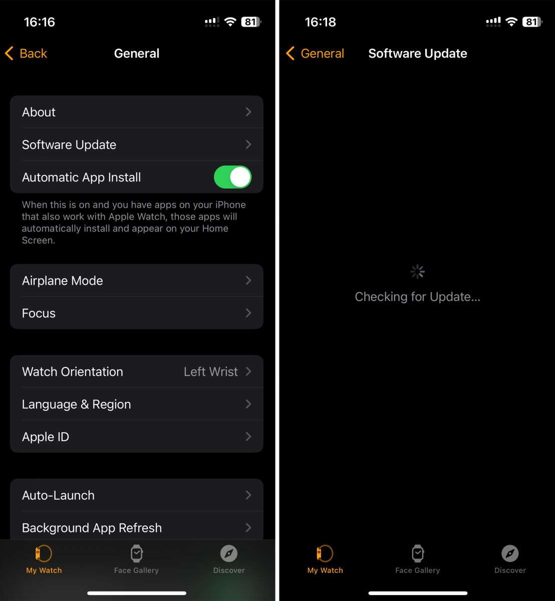 Screenshot of Apple Watch's settings on iOS