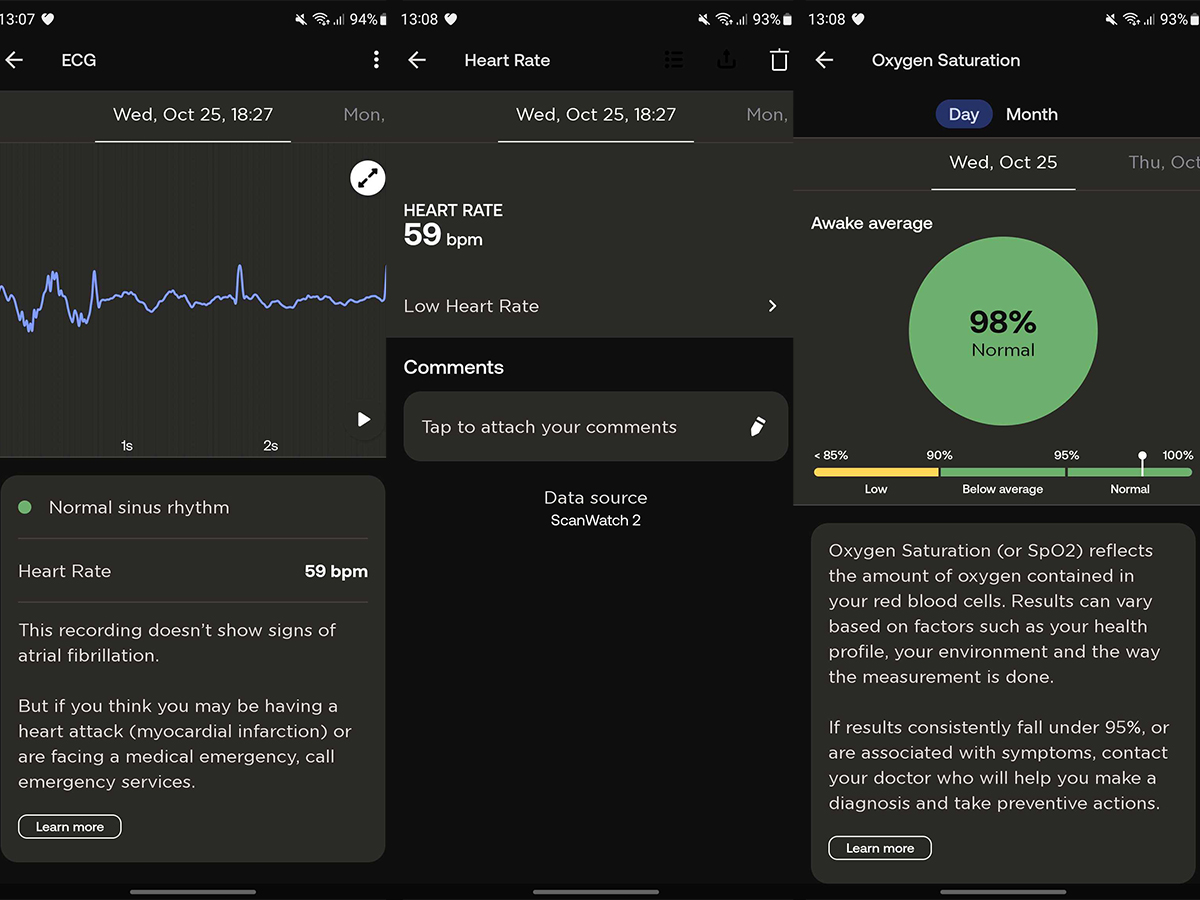 Withings ScanWatch 2 Review: Not That Smart - Tech Advisor