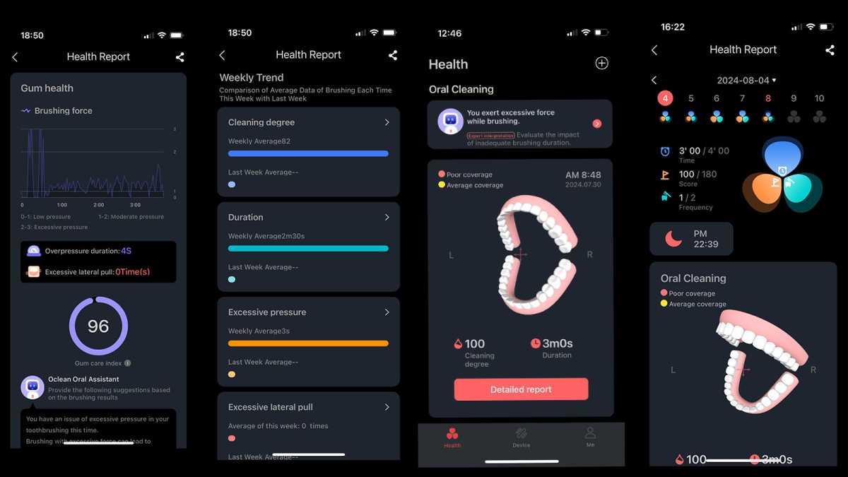Screenshots from the Oclean app, showing brushing reports 
