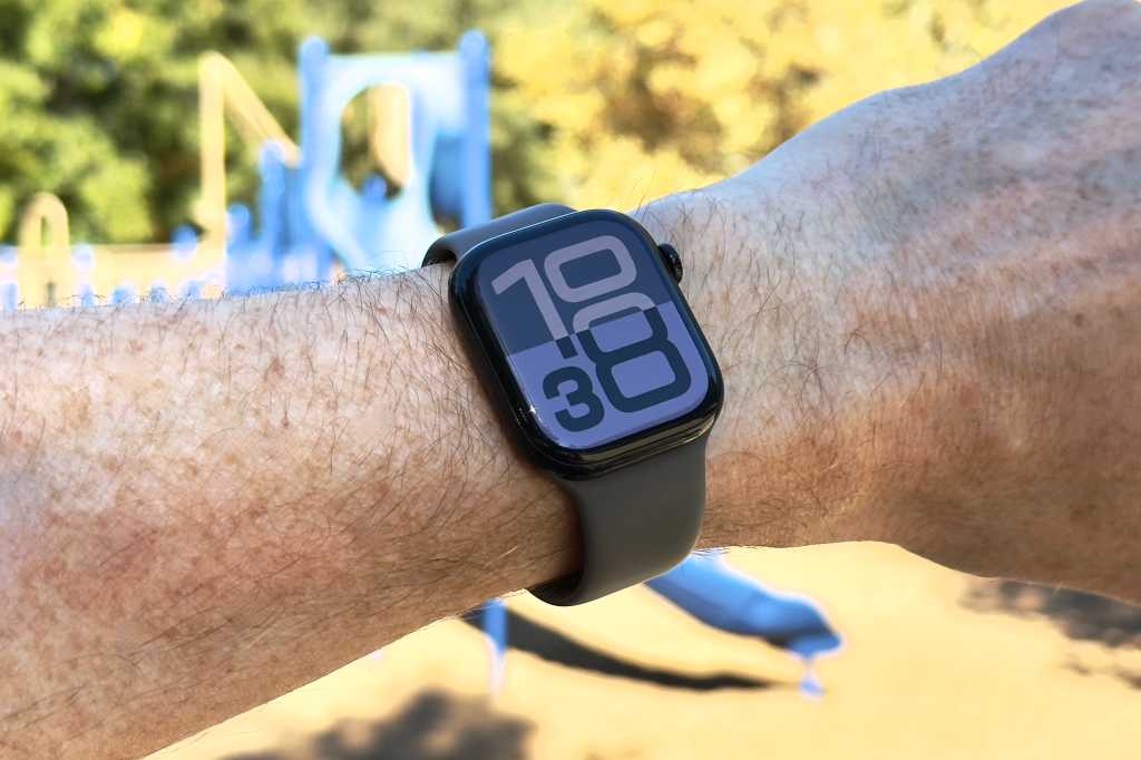 Image: Apple Watch 10 fÃ¼r 329 Euro bei Amazon Italien â gÃ¼nstig wie nie