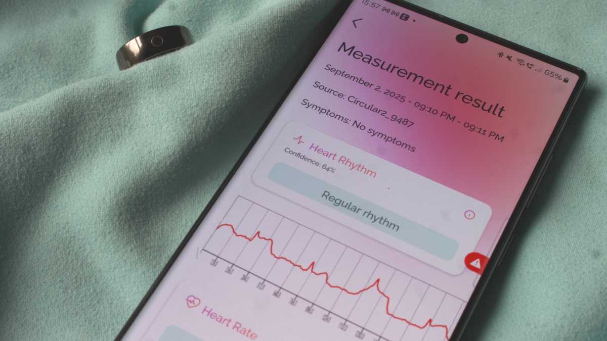 Circular Ring 2 review 1ECG