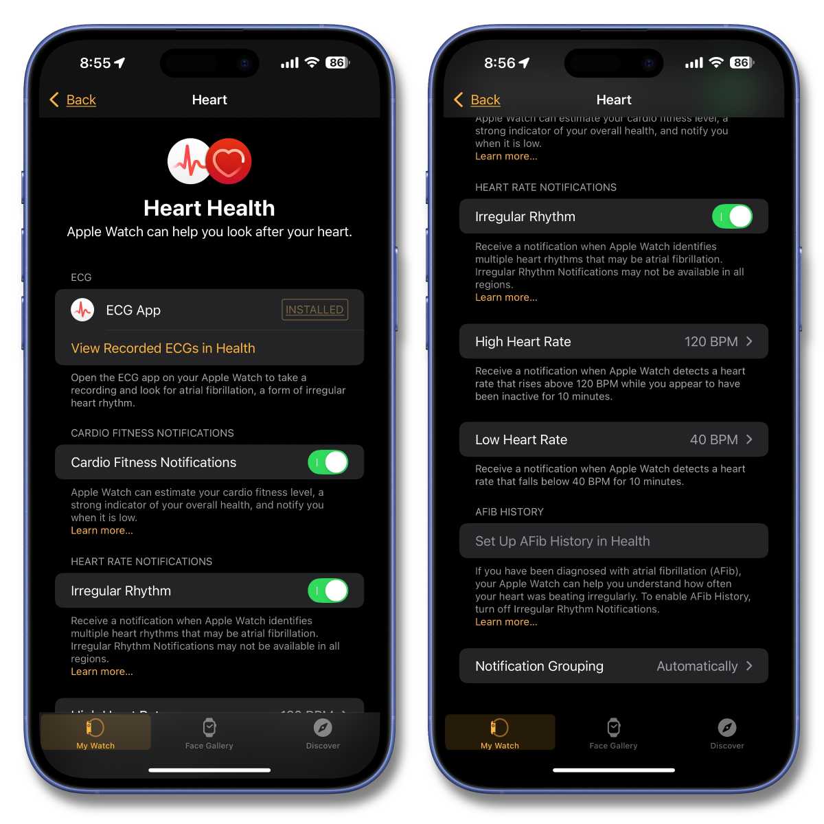 Why couch potatoes should wear an Apple Watch too