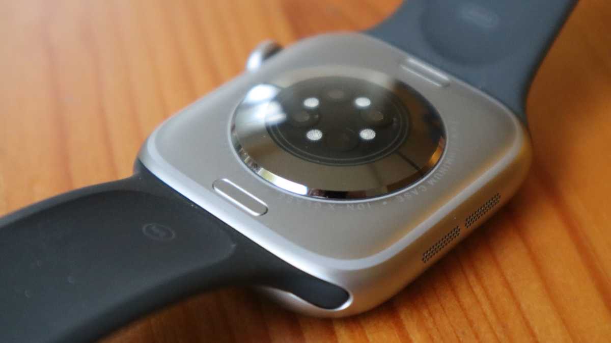 The sensors on the Apple Watch Series 11