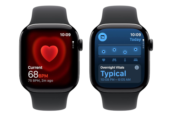 Apple Watch Series 11